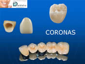 coronadental