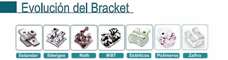 evolucion_del_bracket