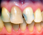 golpedental