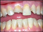 golpedental1